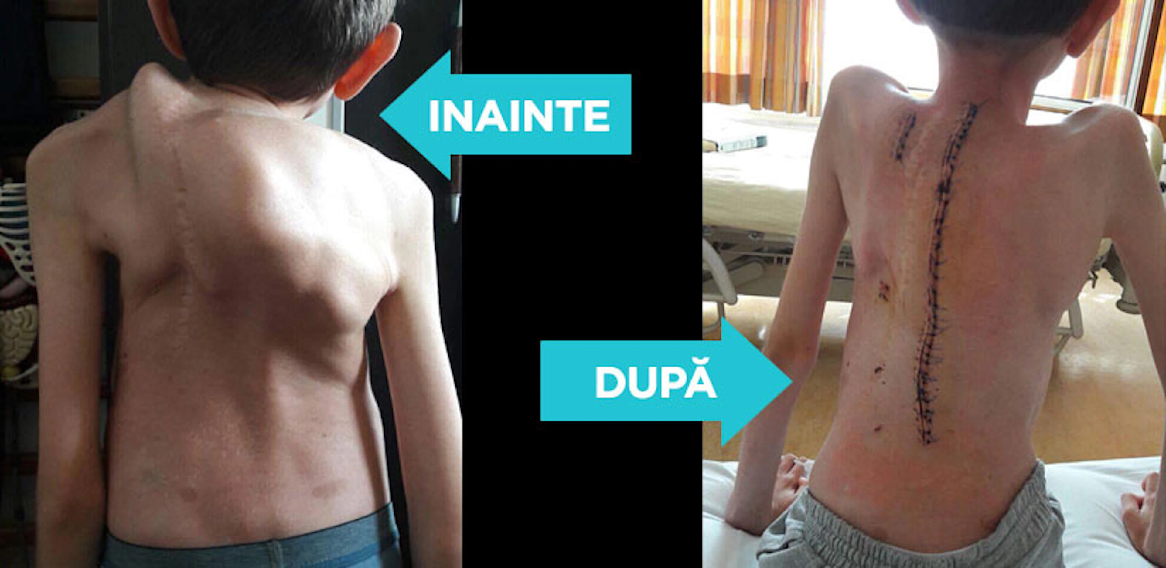 Am consiliat un număr de 148 copii pentru care soluţiile medicale din România au fost epuizate