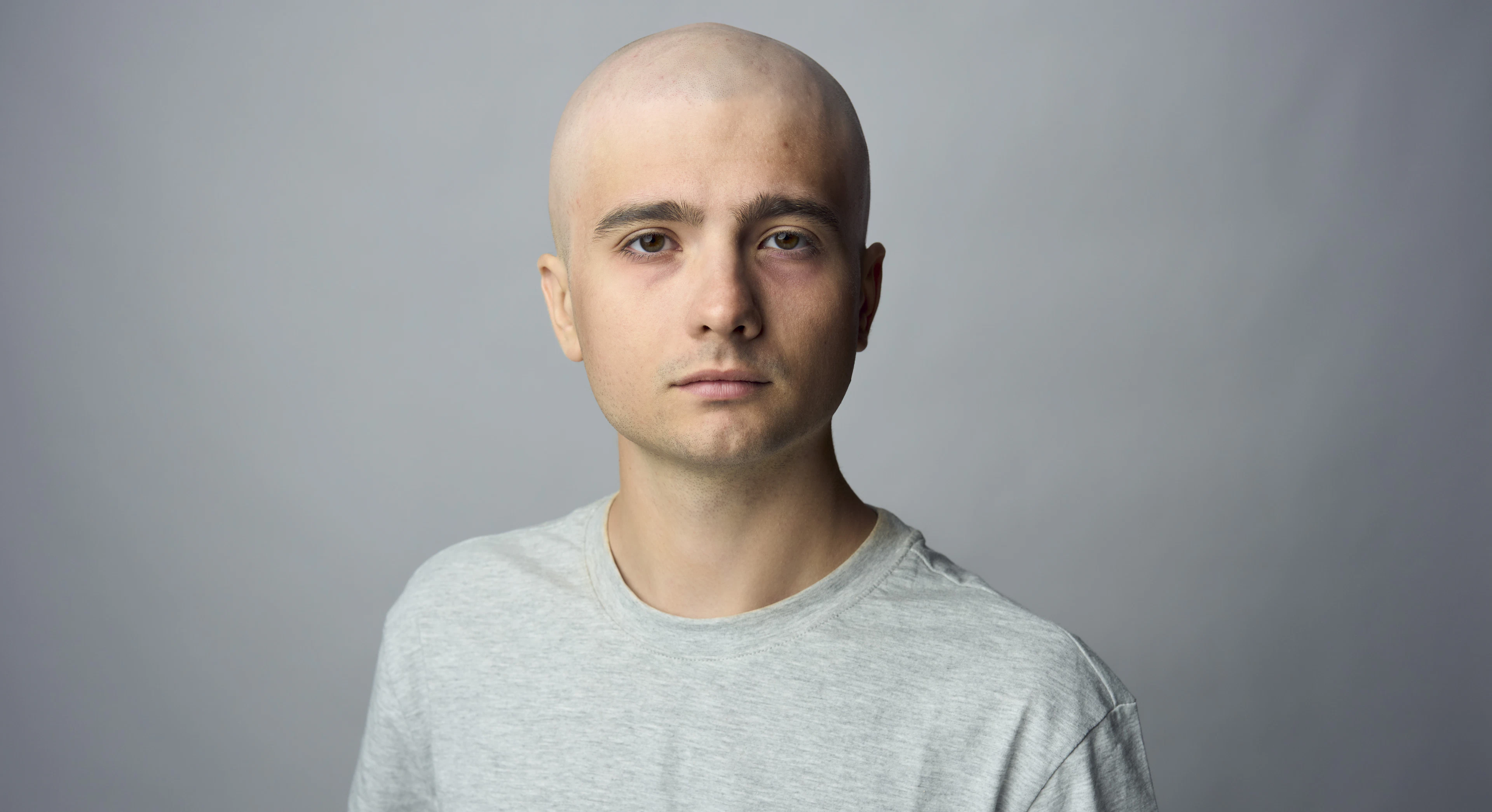Construcția tranziției de la copilul cu cancer la adult, în România